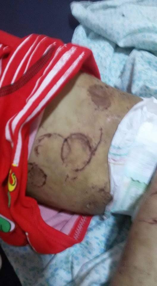 بالصور .. أب يتحول الى "حيوان مسعور" وينهش جسد طفلتيه في النجف