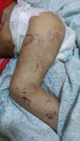 بالصور .. أب يتحول الى "حيوان مسعور" وينهش جسد طفلتيه في النجف
