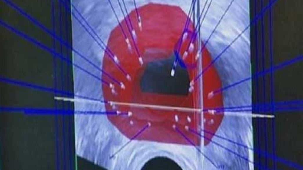 Treatment that eliminates prostate cancer in 90 minutes Treatment that eliminates prostate cancer in 90 minutes