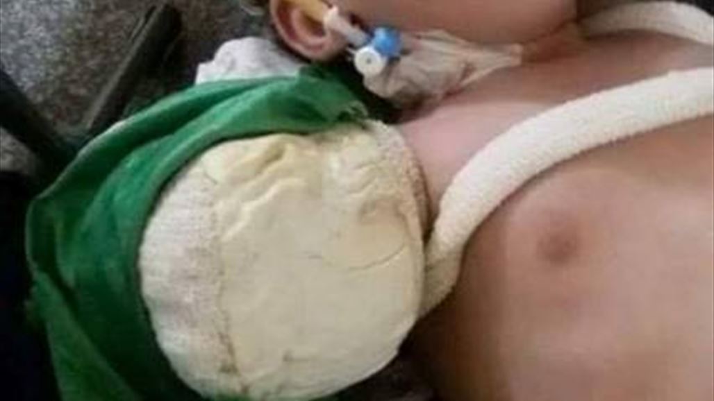 عاجل.. السيستاني يتكفل بعلاج الطفلة رقية.. فما هي قصتها المأساوية؟