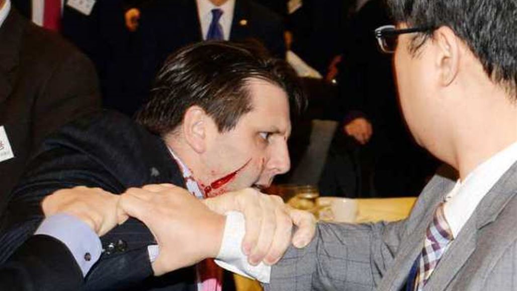 إصابة السفير الأميركي في كوريا الجنوبية بهجوم بشفرة حلاقة