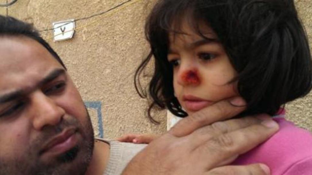 تسجيل اكثر من 100 اصابة بمرض"حبة بغداد" في حزام بعقوبة