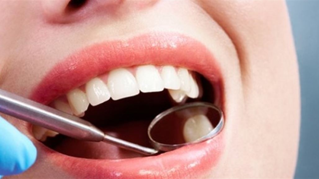علماء يطورون حشوة تحمي الأسنان من إلى الأبد