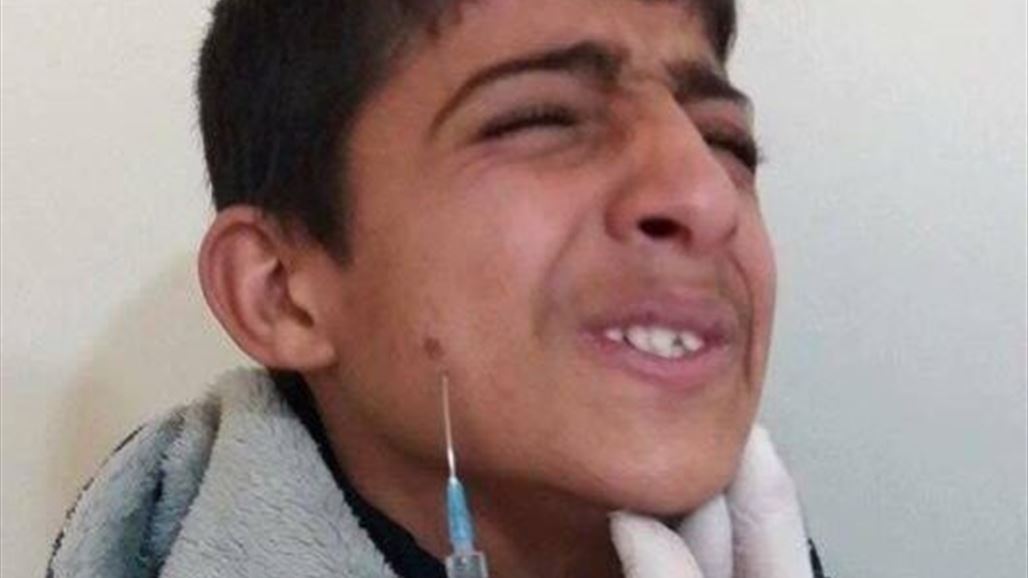 إصابة اكثر من 230 طالبا بمرض "حبة بغداد" في ديالى
