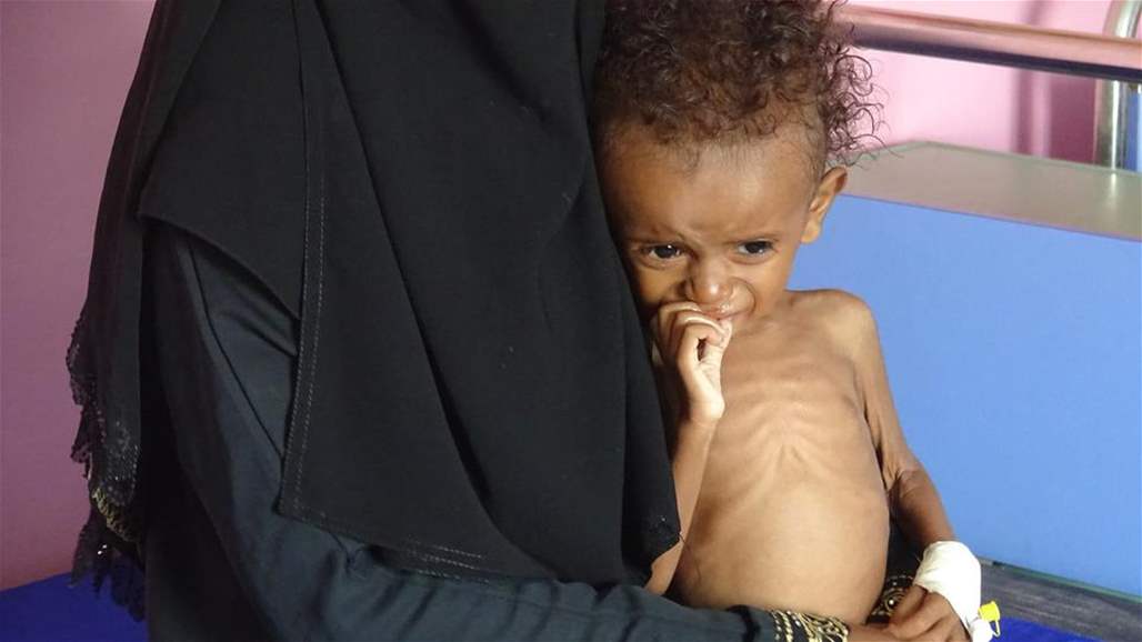الأمم المتحدة: أكثر من 50 مليون شخص يعانون من نقص التغذية بالشرق الأدنى