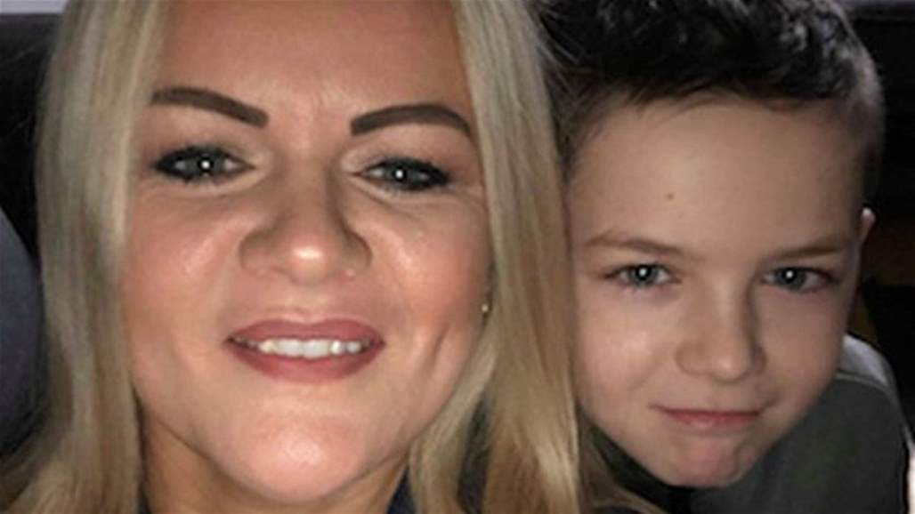 بالصور: كادت أن تصاب بالعمى بسبب حقنة بوتوكس