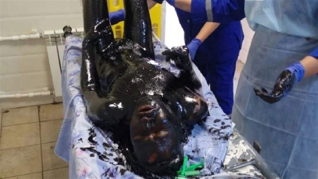 نجا بأعجوبة بعد سقوطه في "نهر من القطران" (صور)