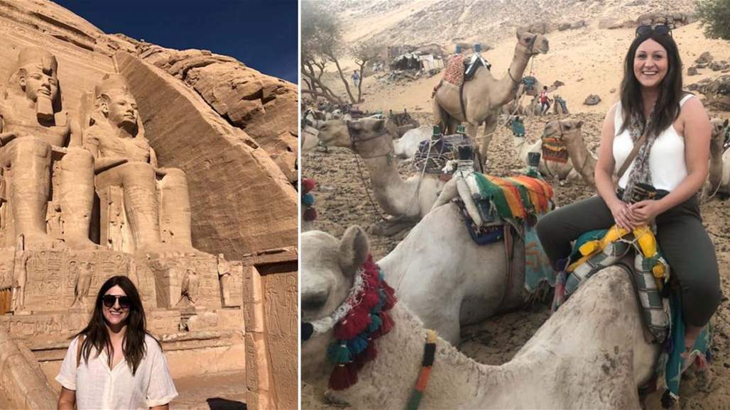 بالصّور: بثور وحروق شوّهت يد هذه الفتاة بسبب وشم الحناء!