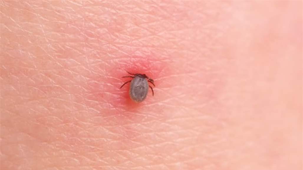 الحشرات أسلحة بيلوجية فتاكة قيد التحقيق!