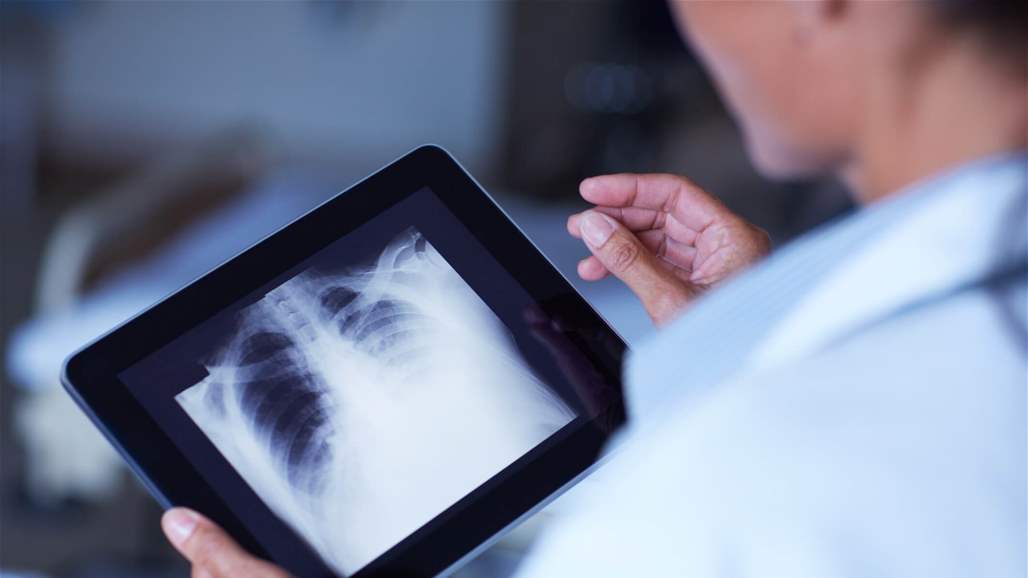 بالصور: لن تتوقعوا ما عثر عليه الأطباء داخل معدة مريض... الأمر صادم!