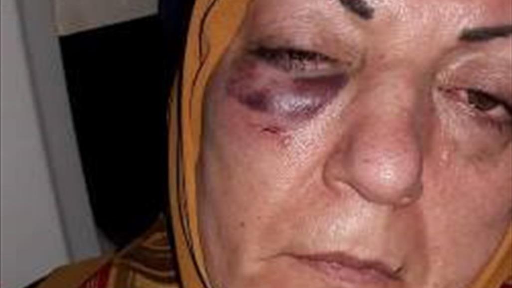 بالفيديو.. المرأة التي تعرضت للضرب من شرطي ايراني في مطار مشهد