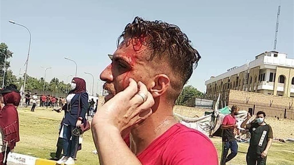 بالصور.. محاضرون يكشفون عن تعرضهم للضرب أمام بوابة مجلس الوزراء