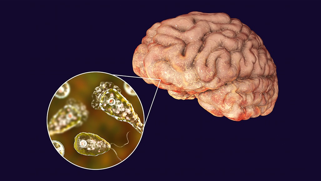 تحذير... عدوى فيروسية آكلة للدماغ!