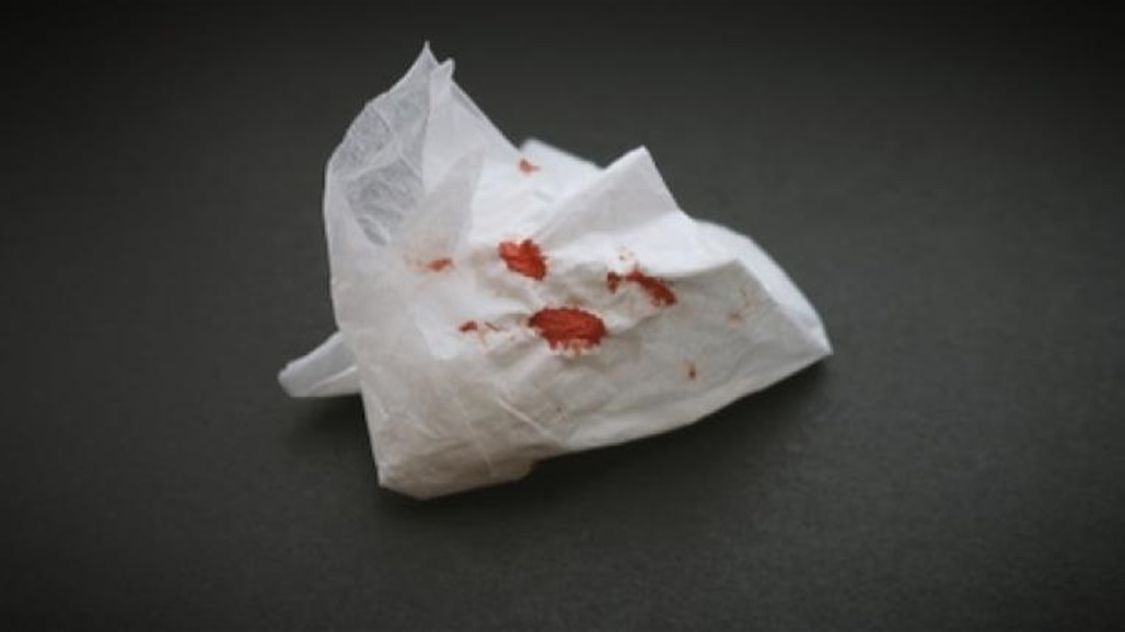 بريطانيا تحذر العالم من تفشي شكل جديد من "السل": يشبه كورونا