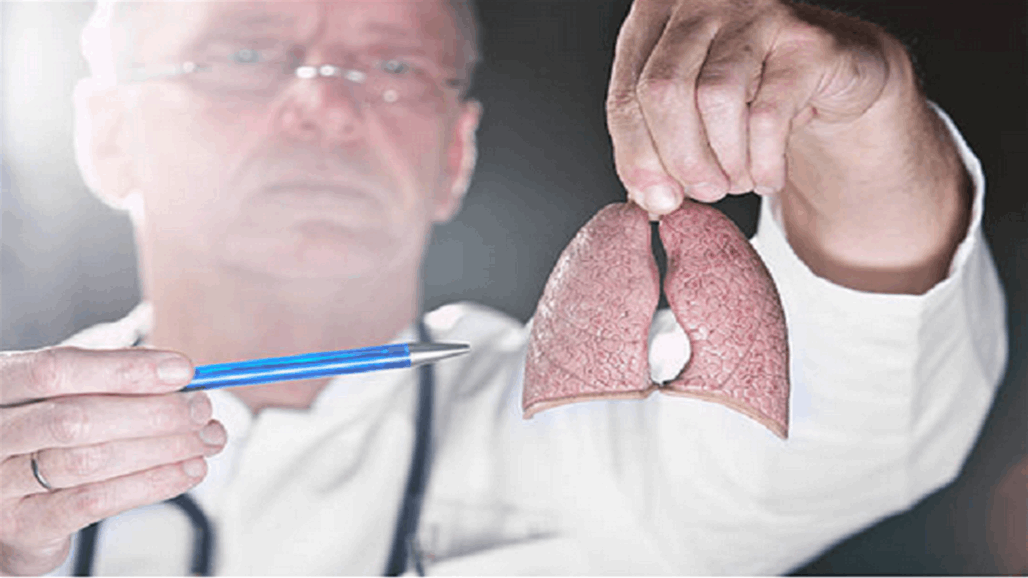 قلق من تفشي "جدري القرود"... شكل جديد من السل!