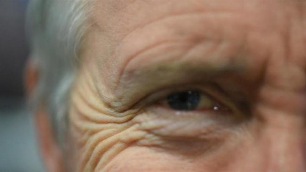 باحثون مصريون يحققون إنجازا طبيا في علاج تجاعيد الوجه!