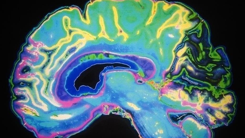 علماء يبتكرون هياكل ثلاثية الأبعاد شبيهة بالدماغ لدراسة وعلاج أمراض المخ