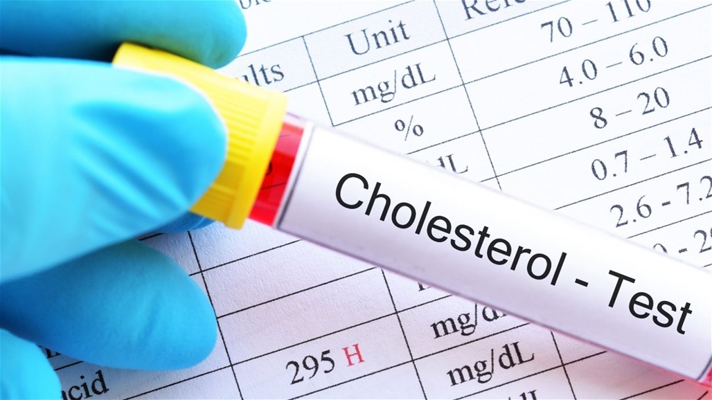 تعرف على أبرز العادات التي ترفع مستوى الكوليسترول في الدم