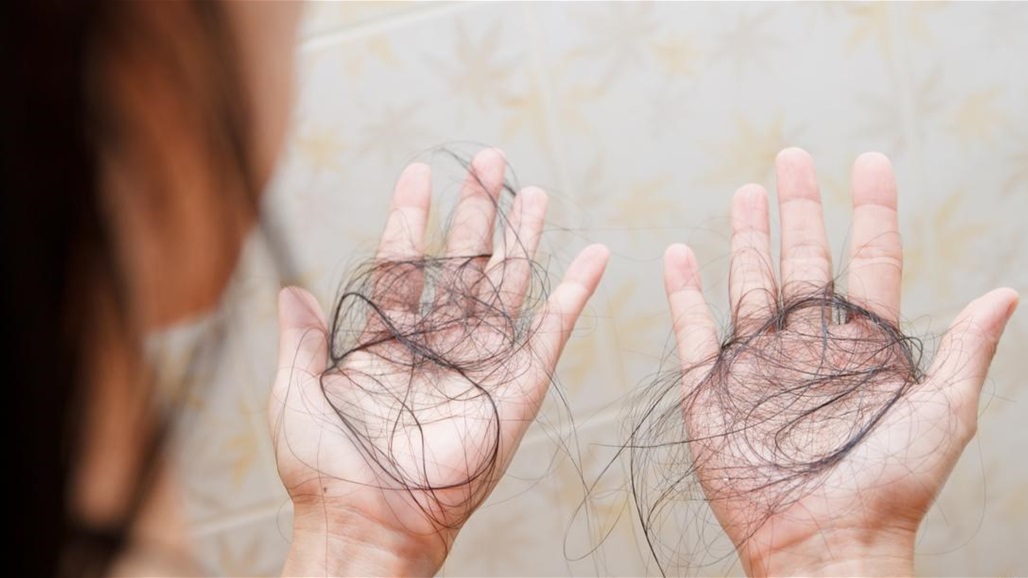 5 عوامل رئيسية تسبب تساقط الشعر!