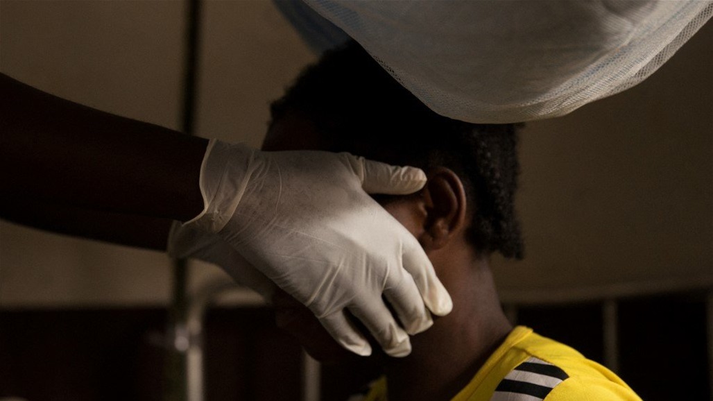 "جدري القردة" يرعب أوروبا وعلماء يوضحون إمكانية تحوله لجائحة تشبه كورونا