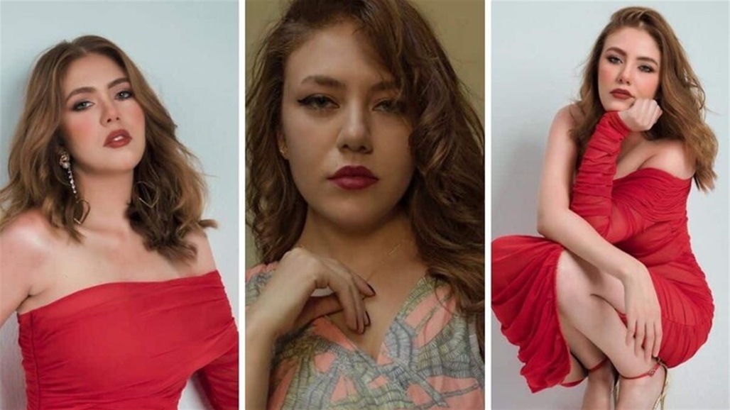 كلب شرس "يعض" فنانة مصرية ويحدث لها نزيفا