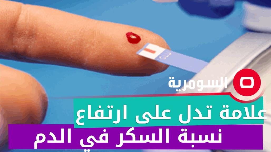 علامة تظهر على القدمين تدل على ارتفاع نسبة السكر في الدم!