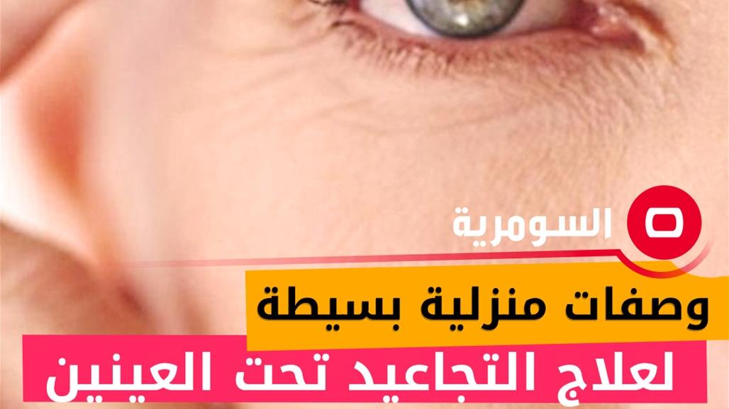 وصفات منزلية بسيطة لعلاج التجاعيد تحت العينين