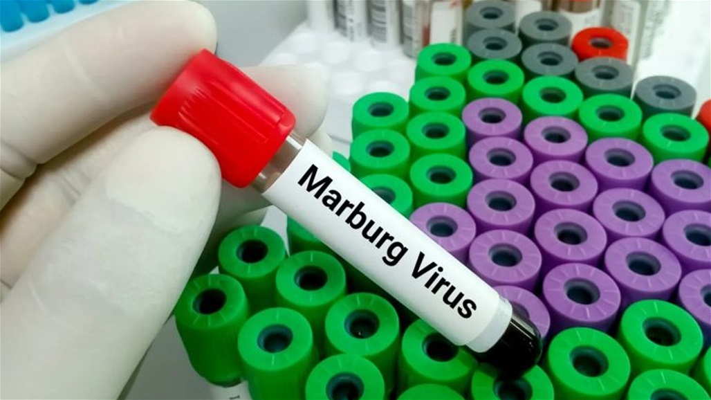 من عائلة إيبولا... كلّ ما عليك معرفته عن فيروس ماربورغ