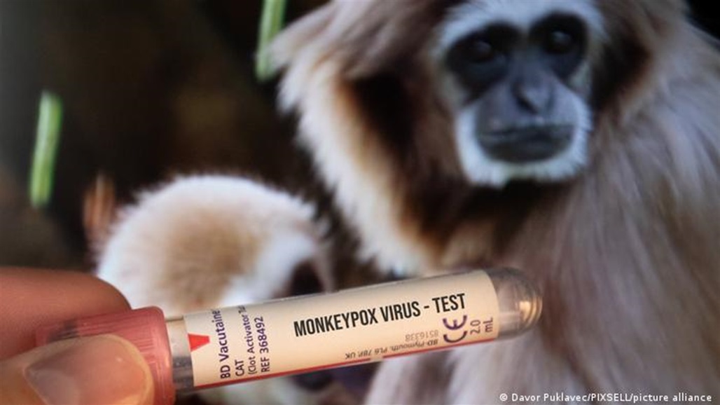 ظهور حالات مؤكدة بجدري القردة في 5 بلدان 
