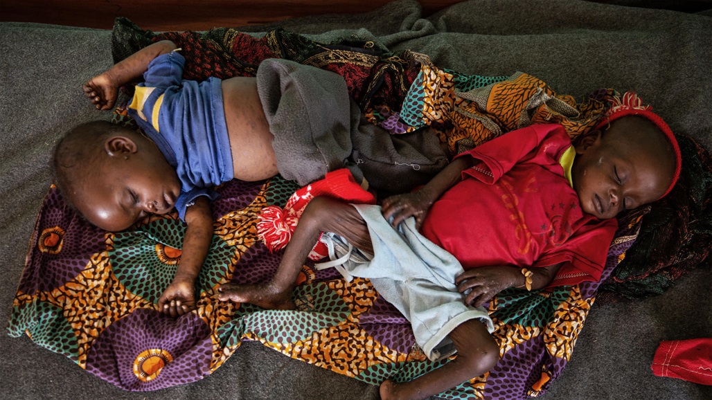 بسبب الحصبة.. وفاة 157 طفلا في دولة افريقية 