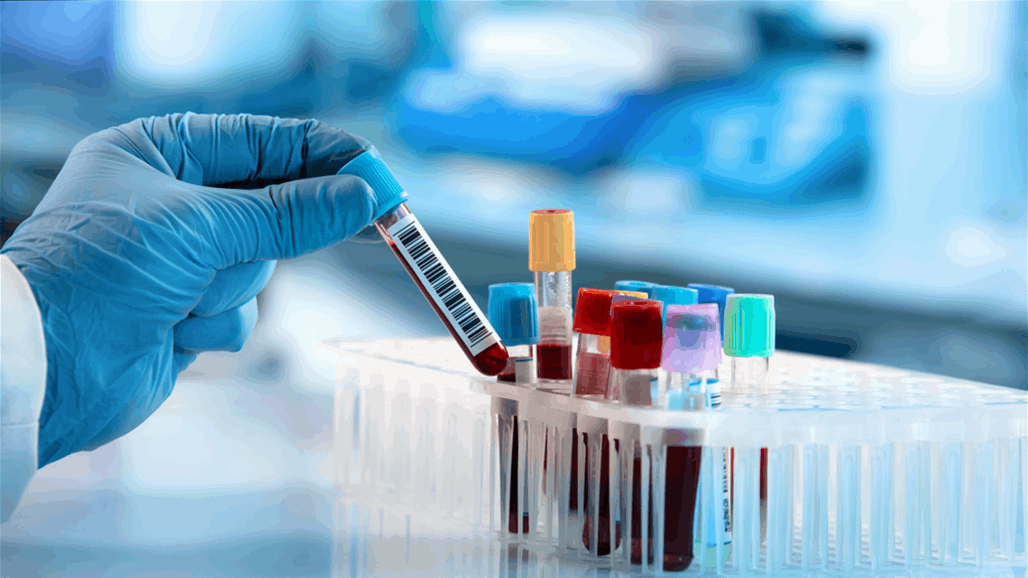 اختبار دم يكشف 50 نوعا من السرطان