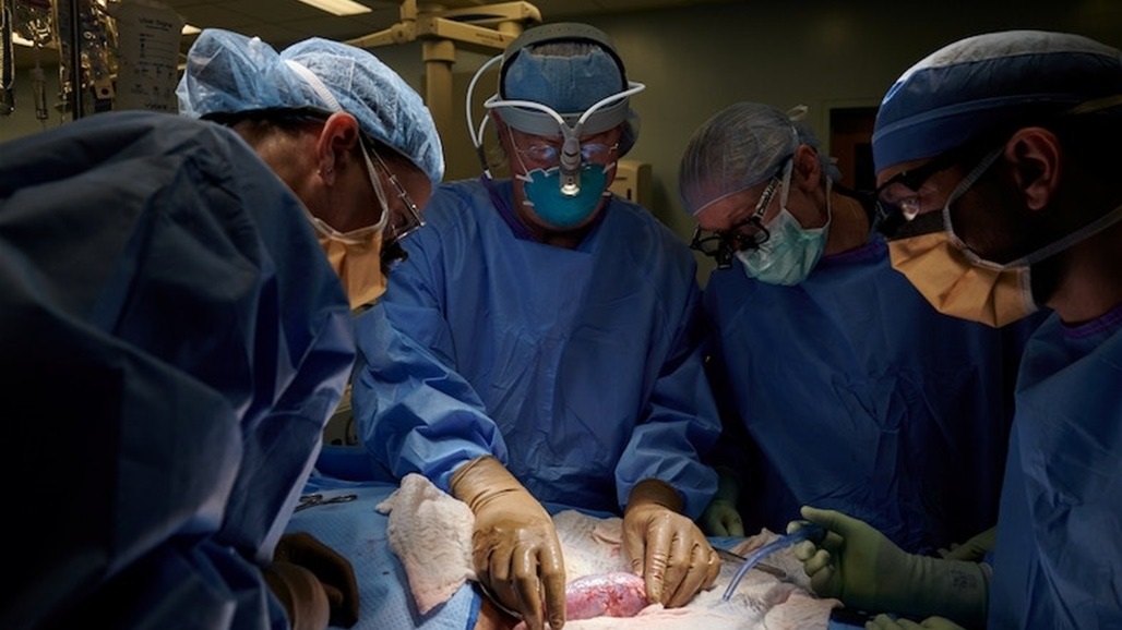 أمل للبشرية.. الصين تنجح بزرع أعضاء الخنازير بالقرود