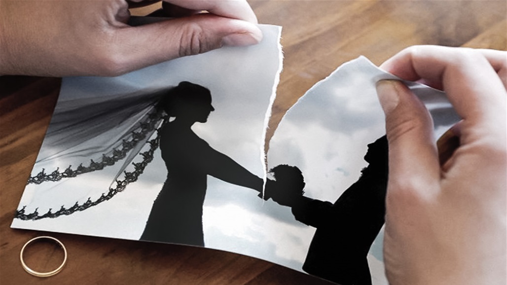 بعد عملية تجميل "فاشلة".. رجل أردني يطلق زوجته