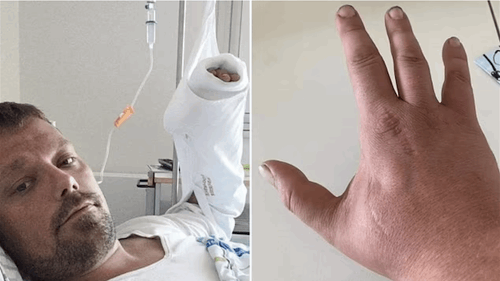 بعد 4 سنوات على الحادثة.. "عضة" قطة تنهي حياة شاب دنماركي!