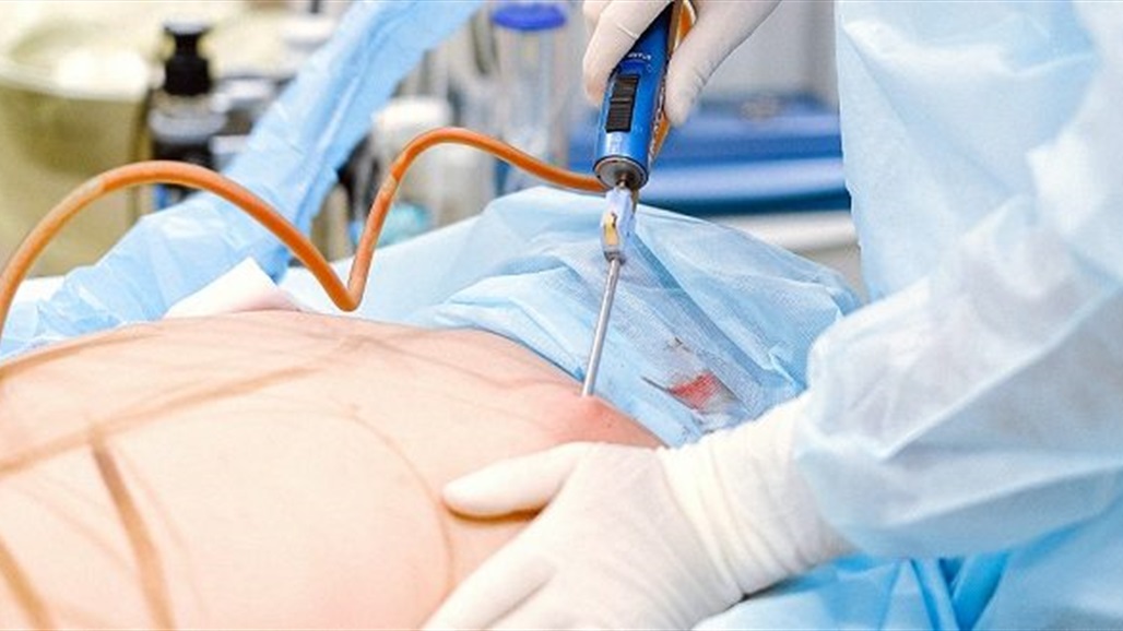 أبرزها &quot;شفط الدهون&quot;.. تعرف على أكثر أشكال الجراحة التجميلية شيوعا في العالم