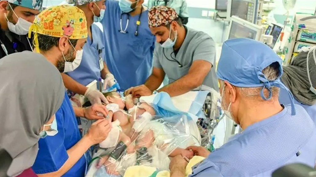 السعودية.. ردة فعل والد &quot;التوأم السيامي&quot; العراقي لحظة فصل ولديه (فيديو)