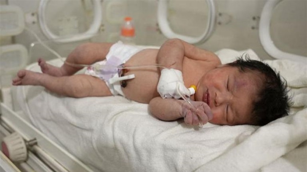 بعد انتشالها من تحت الانقاض.. الكشف عن صحة  "الطفلة الاعجوبة" 