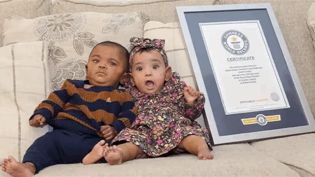 بمدة حمل قصيرة.. ولادة توأمين تدخل موسوعة غينيس