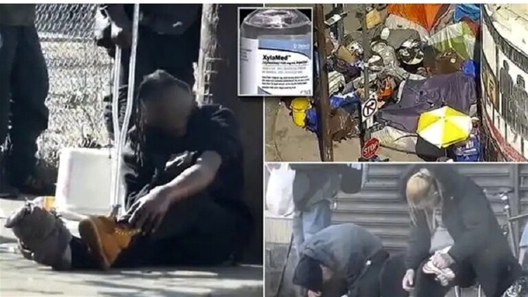 مشاهد ’صادمة’.. مخدر ’الزومبي’ يُثير الرعب في الشوارع الأمريكية 