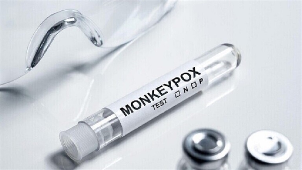 الصين تسجيل إصابتين جديدتين بجدري القردة