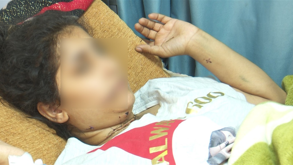 "حاول ذبحها".. شابة تتلقى 20 طعنة بالسكين من زوجها ووالدها يروي للسومرية التفاصيل (فيديو و صور) 