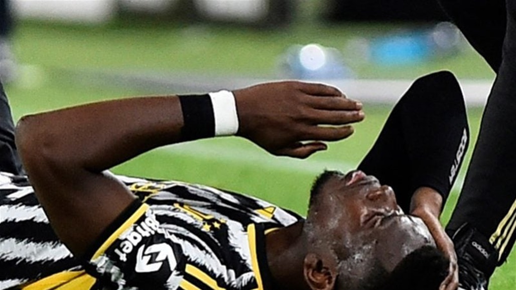 يوفنتوس يكشف عن طبيعة إصابة بوجبا