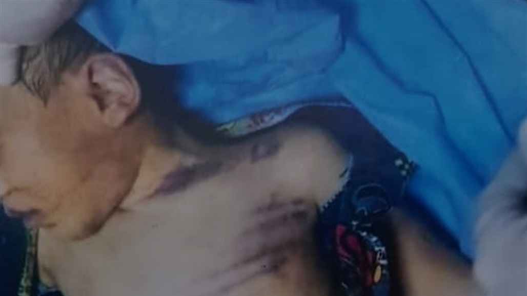 من قبل والدهم وزوجته.. أم تروي لـ السومرية تفاصيل قتل وتعنيف أطفالها