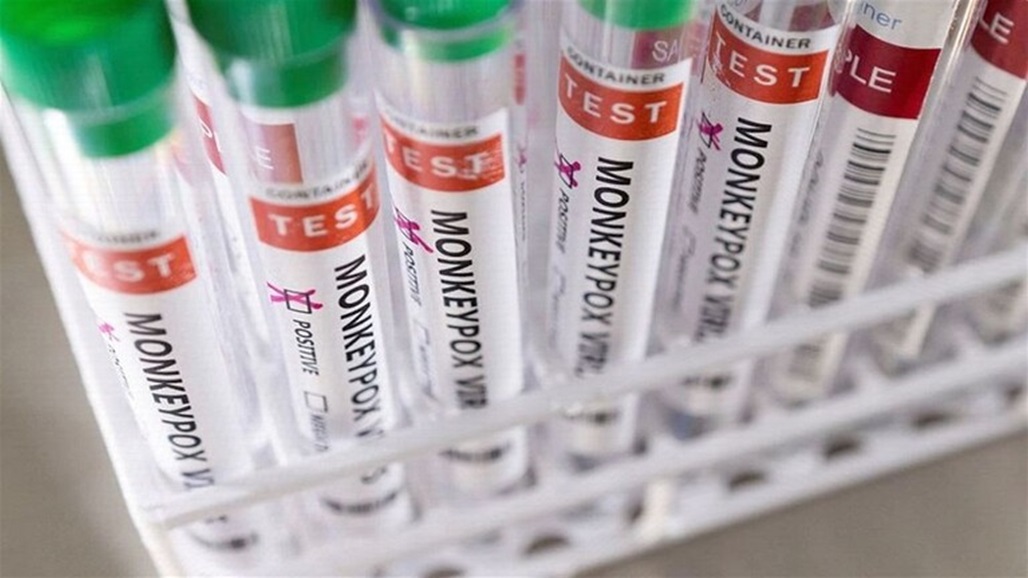 الصحة العالمية: "الاتصال الجنسي" سبب لانتشار جدري القردة في الكونغو