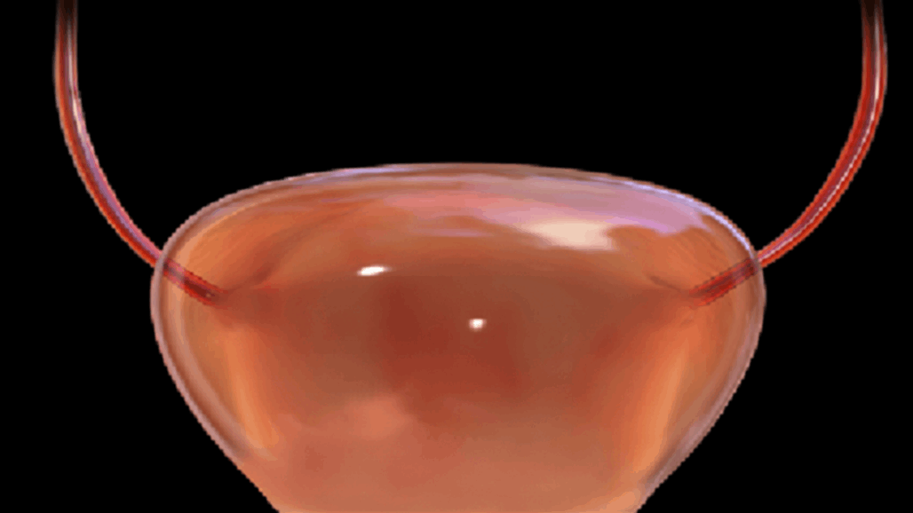 ابتكار جديد يعالج سرطان "المثانة" الشائع لدى الرجال 