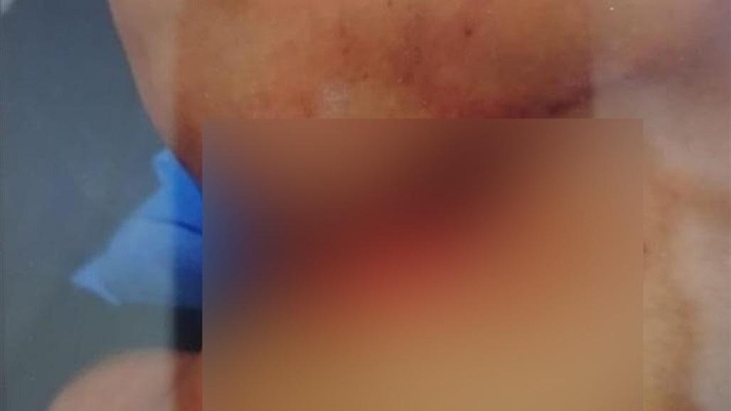 بسبب خلافات عائلية.. امرأة "تذبح" والدة زوجها في بغداد (صور) 