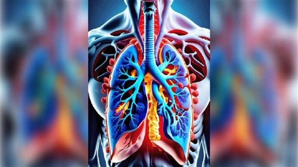 اكتشاف خطير لتأثير فيروس "كورونا" الشديد على الرئتين