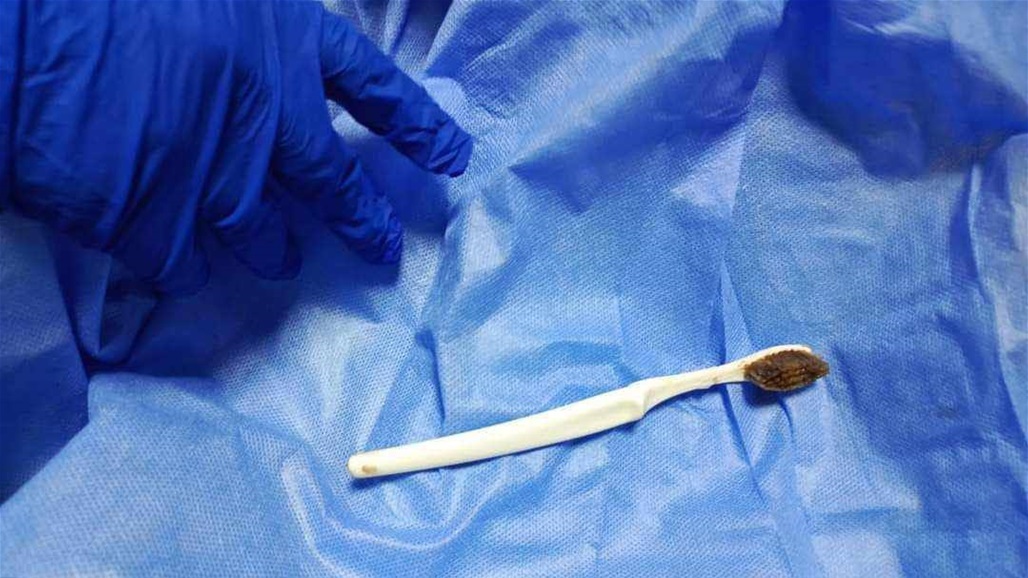 ابتلعها بالخطأ.. استخراج "فرشاة أسنان" من معدة شاب ثلاثيني في بغداد