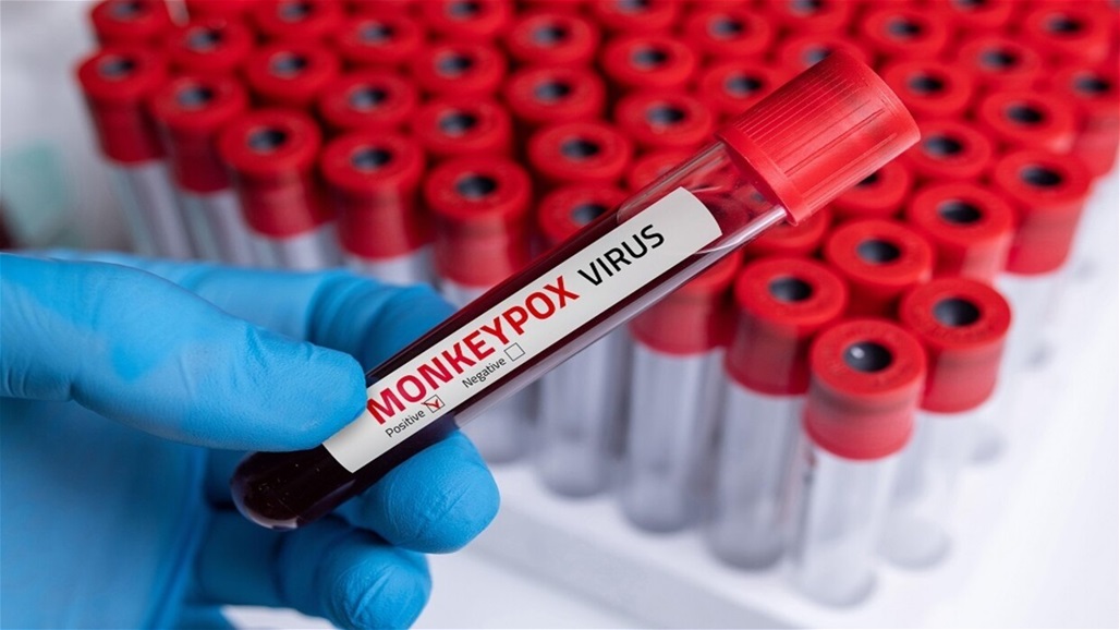 هل توجد مبرّرات كافية لإدخال لقاح "جدري القردة" إلى العراق؟