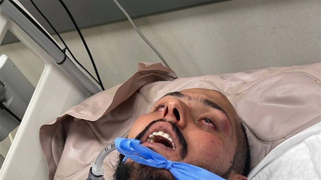 تفاصيل تعرض مهندس لتعذيب وحشي على يد ضابط في الشرطة الاتحادية ببغداد